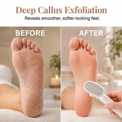 One-Pass Callus Remover